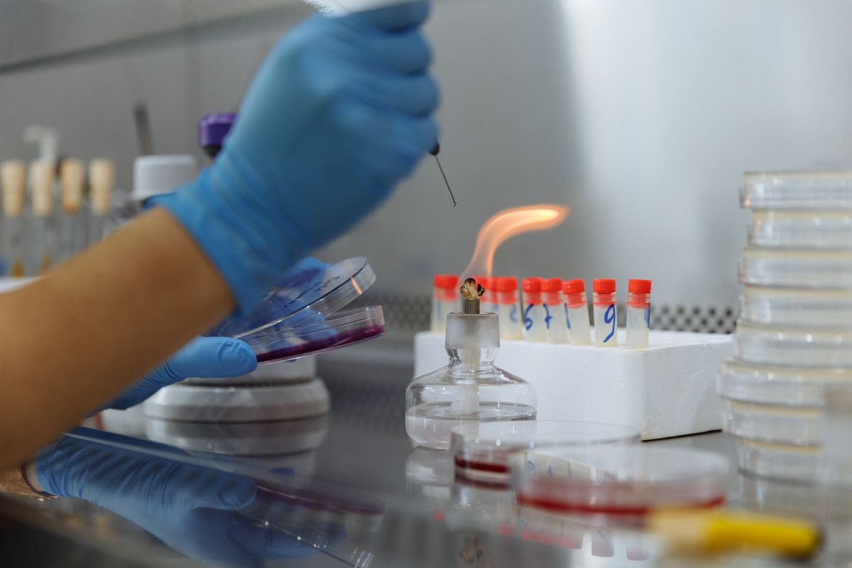 UHPLC: Sub-2µm Partikül Teknolojisi ve Avantajları